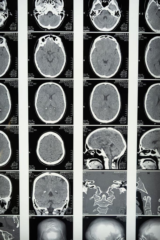 Comprehensive set of brain MRI scans, a useful tool in neuroplasticity study